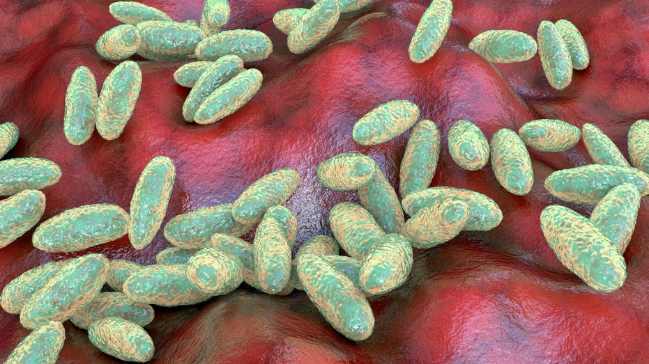 us-monitoring-suspected-fatal-pneumonic-plague-case-in-russia,-state-department-official-says